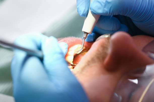 Best Emergency Gum Pain Relief  in Foley, MN